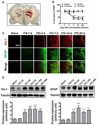 SDF1-CXCR4 Signaling Maintains Central Post-Stroke Pain through Mediation of Glial-Neuronal Interactions